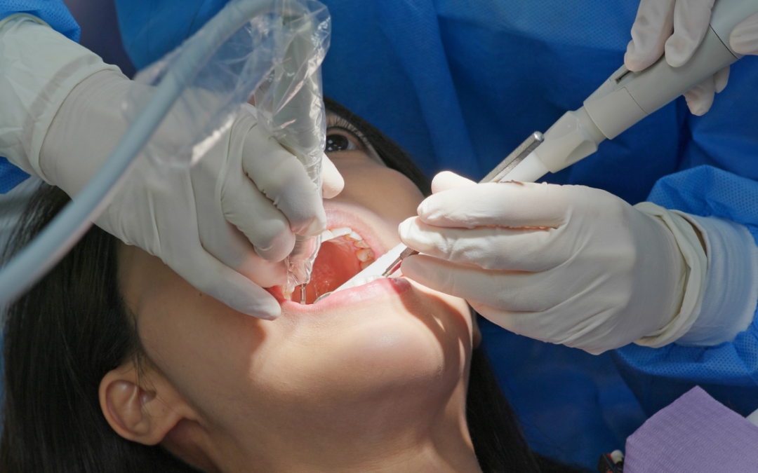 Raspagem periodontal e seu papel no controle das doenças gengivais: